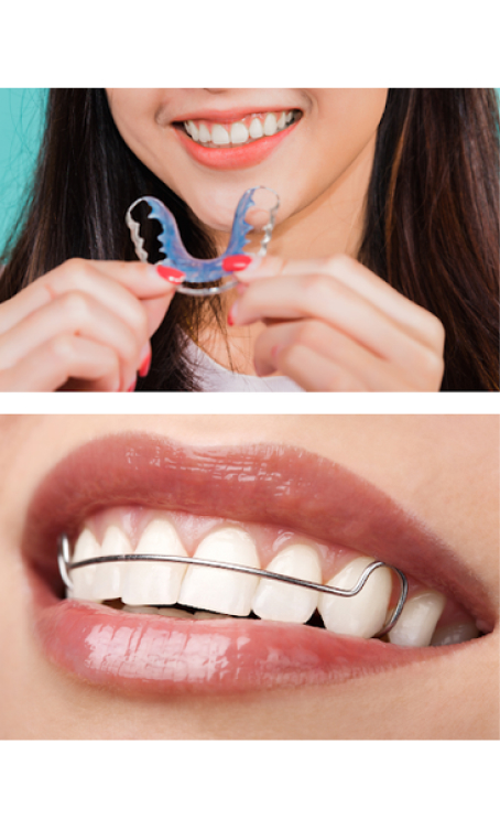 7 Ways Mouthguards Help with Clenching