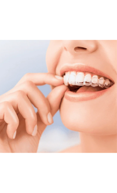 7 Ways Mouthguards Help with Clenching