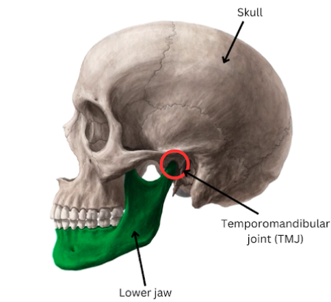 Can Grinding Teeth Lead to Migraines? A Comprehensive Look