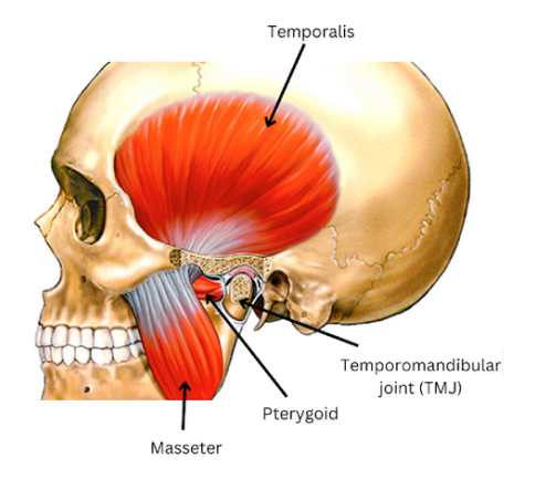 Can Grinding Teeth Lead to Migraines? A Comprehensive Look