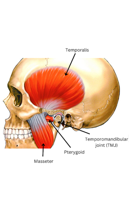 Can Grinding Teeth Lead to Migraines? A Comprehensive Look