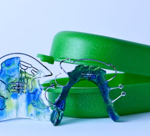 Retainers After Braces: Essential Guide to Maintaining Alignment