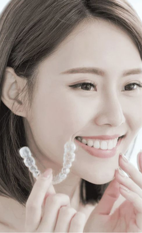 Retainers After Braces: Essential Guide to Maintaining Alignment