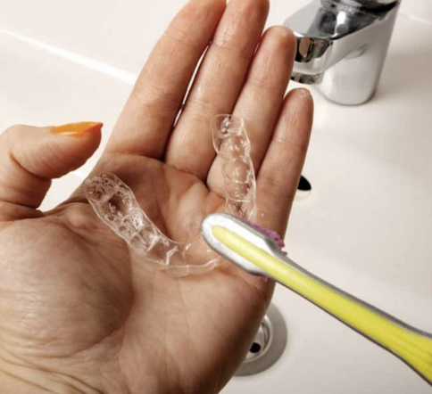 Retainers After Braces: Essential Guide to Maintaining Alignment
